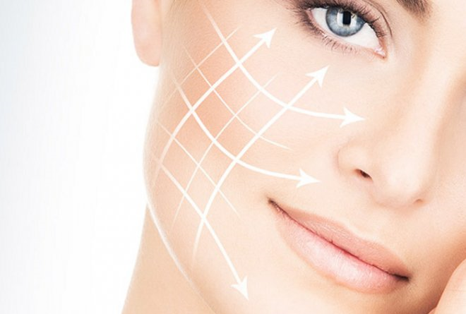 Los hilos tensores: mentiras y verdades, Tratamiento estético que ayuda a combatir la flacidez facial