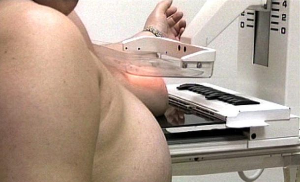 una-paciente-en-un-hospital-pacientes-de-cancer-de-mama-con-metastasis-viven-el-doble-que-hace-20-anos-archivo-efe