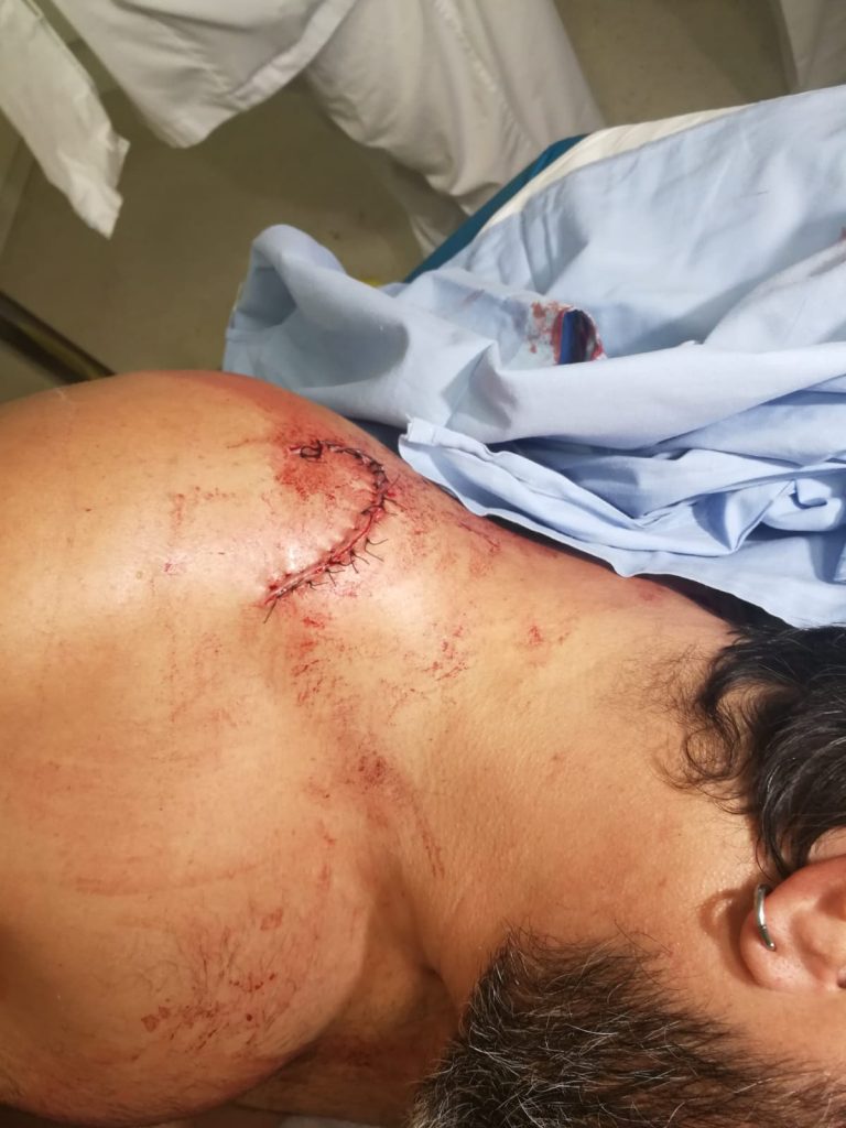 Un vecino con 17 puntos tras ataque de los okupas en La Llagosta (Barcelona)