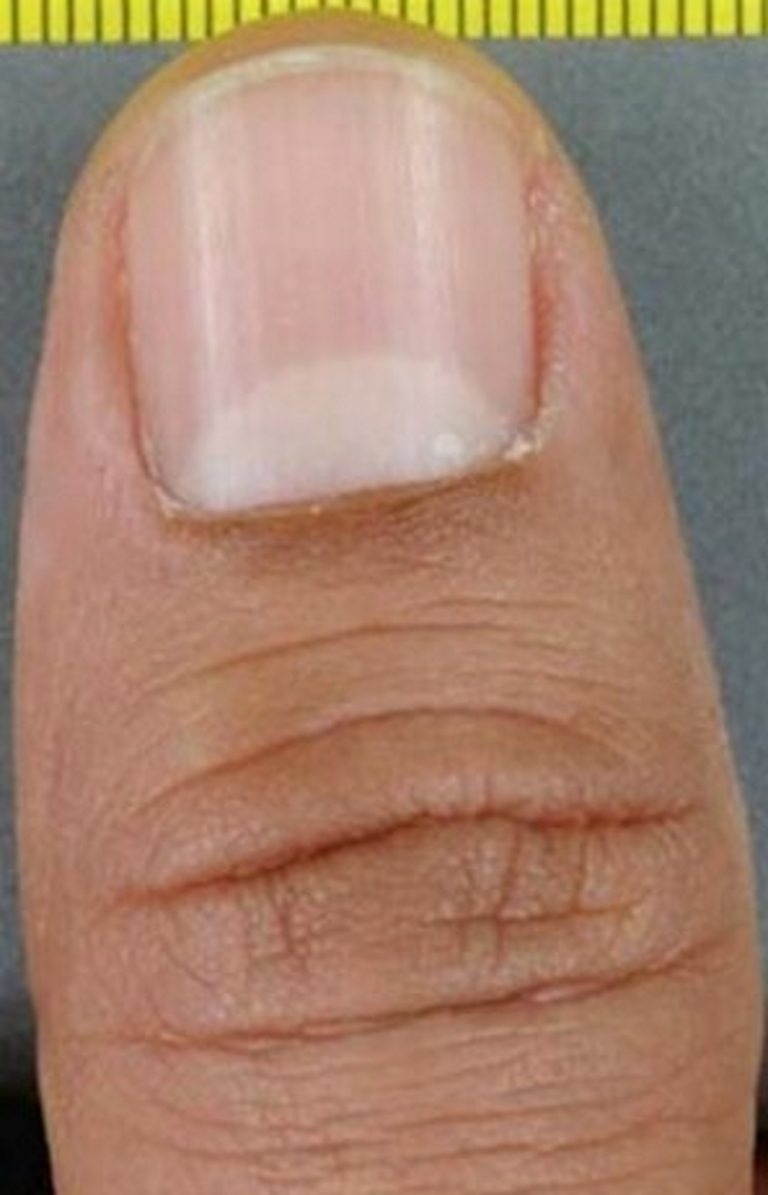 Los nudillos, determinantes para resolver y condenar a los agresores sexuales