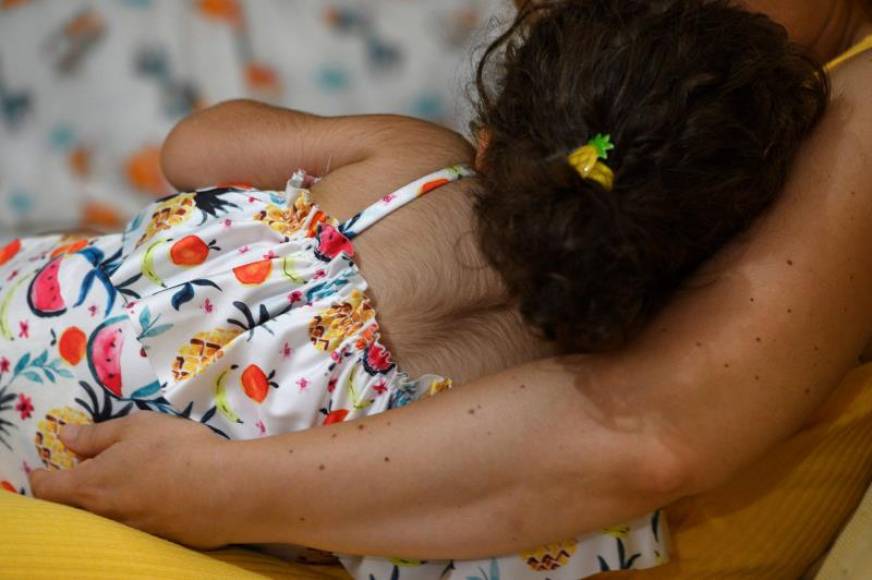 FOTOGRAFÍA. COLINDRES (CANTABRIA) ESPAÑA, 29.08.2019. Una de las menores a las que le ha crecido vello en todo el cuerpo por tomar omeprazol defectuoso, Colindres. Efe