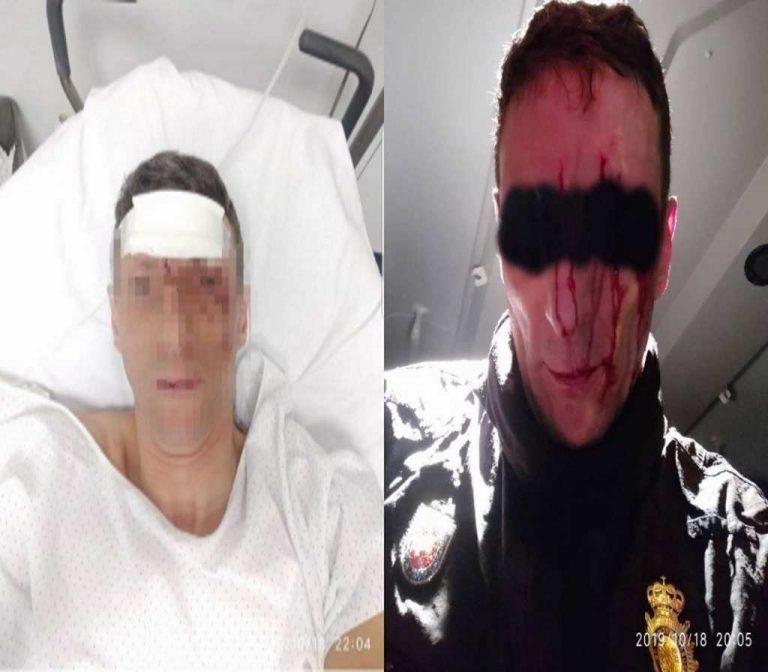 El Policía atacado el 18-Oct en Cataluña «está en observación pero consciente»