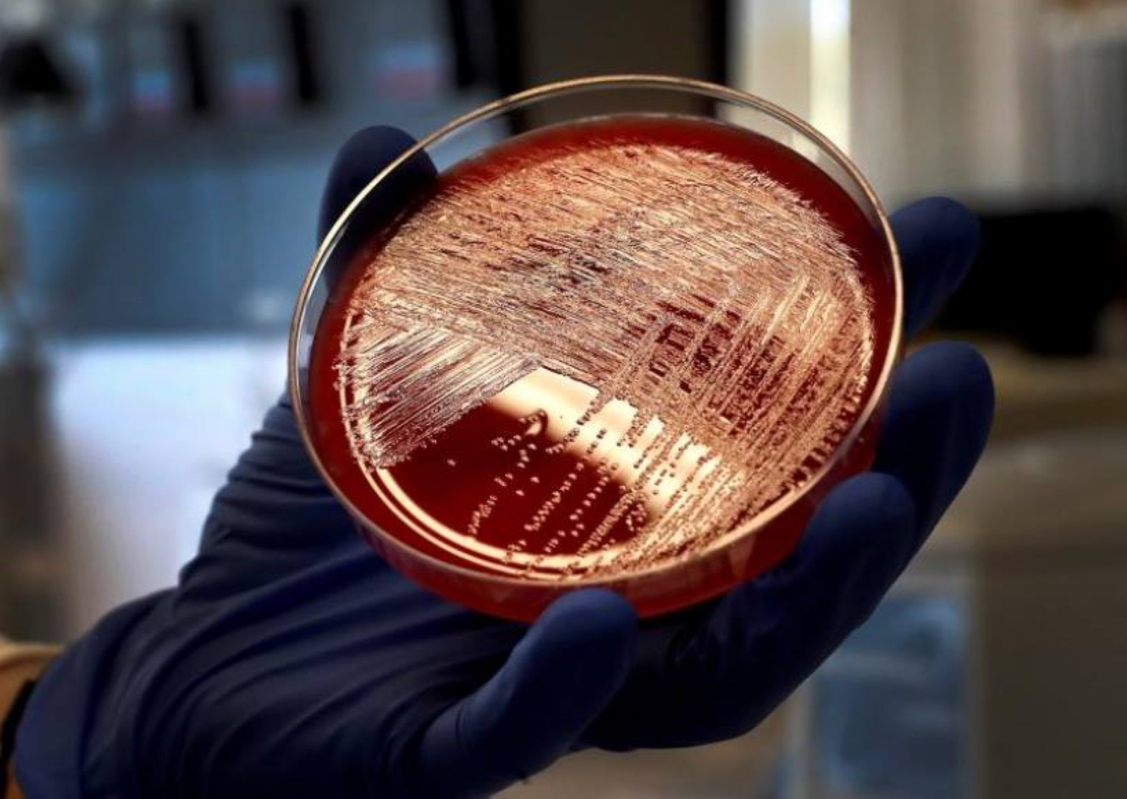 FOTOGRAFÍA. BARCELONA (ESPAÑA), 11.12.2019. Dos estudios en los que han participado investigadores del Vall d'Hebron Instituto de Oncología (VHIO) y del Hospital Quirón de Madrid. Efe