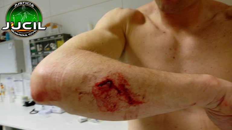 Nueva agresión a 2 guardias civiles en Alsasua, «ecosistema de odio» separatista proetarra