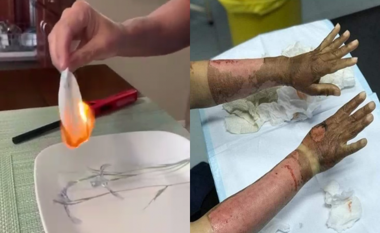 «Tengan cuidado con el gel desinfectante para manos para evitar el contagio de coronavirus»