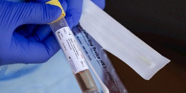 Cataluña hará los Tests del COVID 19 al personal sanitario «a partir del 18 de mayo de 2020»