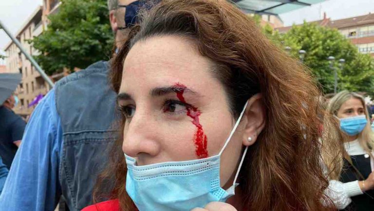 Parte Médico Rocío de Meer 2 días después: «Leve tumefacción con leve hematoma en la zona de la ceja»