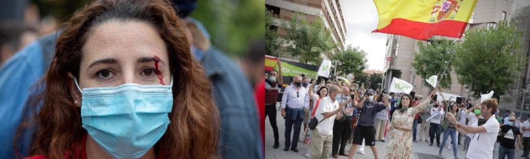 COMBO DE FOTOGRAFÍAS. SESTAO (VIZCAYA), 26.06.2020. Herida la diputada de VOX en el congreso, Rocío de Meer. BARACALDO (ESPAÑA), 10.07.2020. Ñ Pueblo (2)