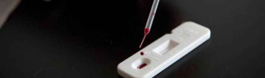 FOTOGRAFÍA. ESPAÑA, 14.08.2020. Vista de un prueba de coronavirus. Efe