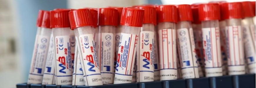 FOTOGRAFÍA. ROMA (ITALIA), 23.08.2020. Vista de la vacuna contra el covid 19 (coronavirus) de Italia. La vacuna, creada, producida y patentada por la empresa biotecnológica italiana ReiThera. Efe