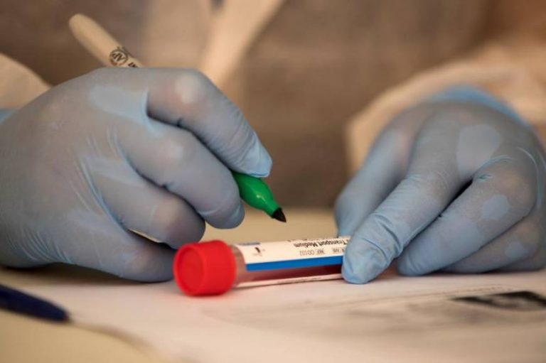 El mundo registra 29.100.000 de contagios del covid 19 y un total de 926.544 muertos