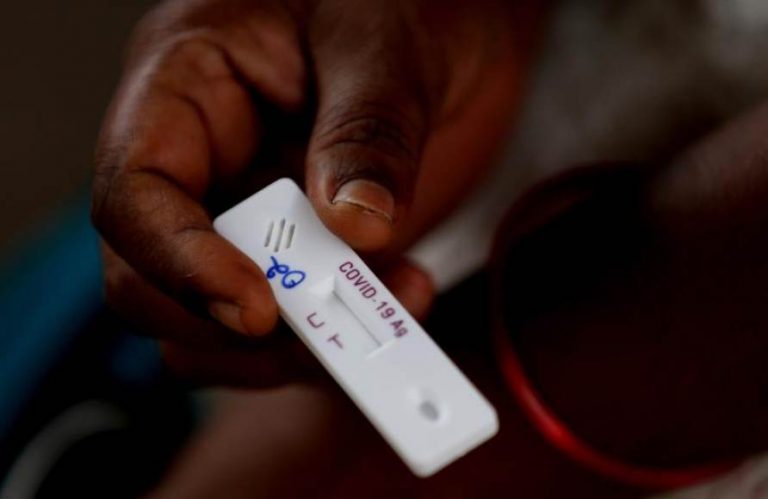 Los casos globales de covid 19 alcanzan los 30.400.000 y número de fallecidos se eleva a 948.795