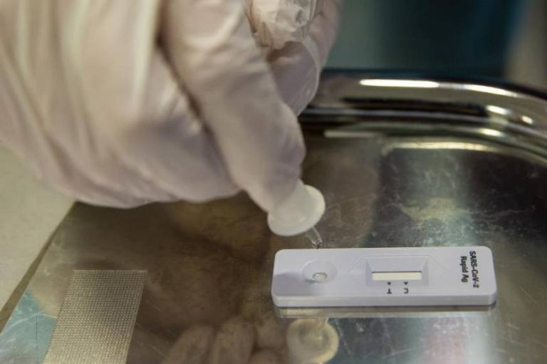 Sanidad notifica 411 muertos por covid 19 en España