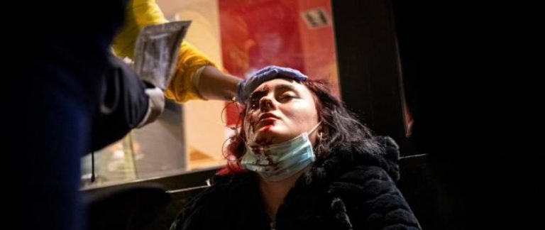 Usan a un «free lance» para ir a por el profesional de los Mozos que actuó legalmente contra la ultra que perdió un ojo por Pablo Hasel