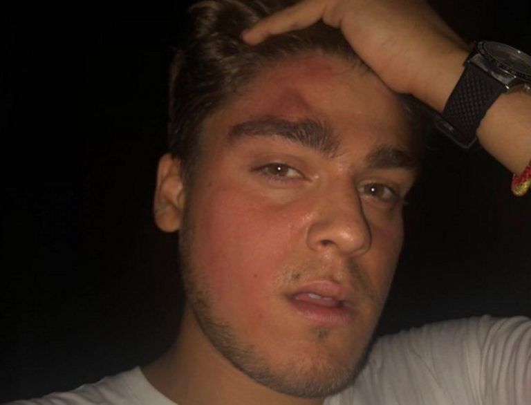 Tres MENAS atacan a puñetazos a un joven catalán en Sant Cugat de Vallés (Barcelona)