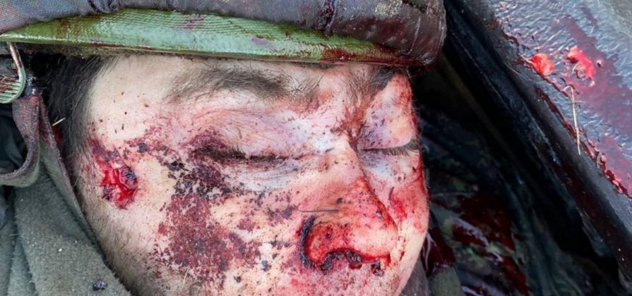 FOTOGRAFÍA. UCRANIA, 27.02.2022. Soldados rusos muertos en Ucrania. Una acción del batallón de Azov del Ejército de Ucrania acaba con una columna de las tropas invasoras rusas. Fuerzas Armadas de Ucrania / Lasvocesdelpueblo (Ñ Pueblo). Lasvocesdelpueblo (Ñ Pueblo)
