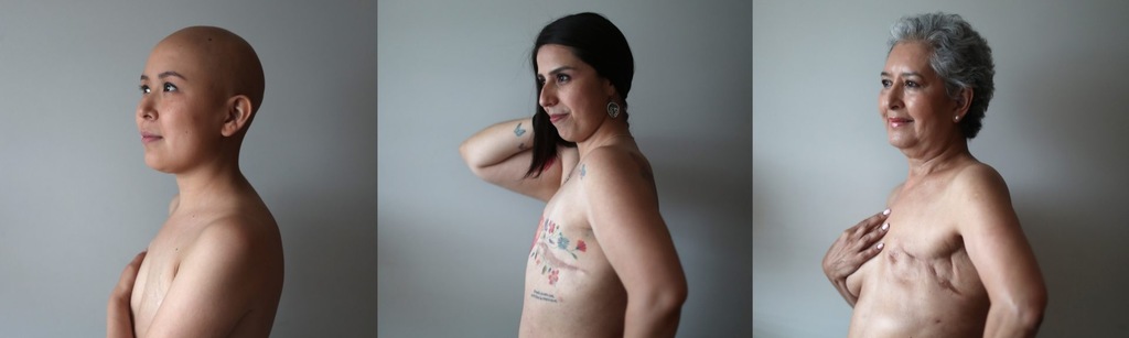 cáncer de mamá 2022,Lasvocesdelpueblo