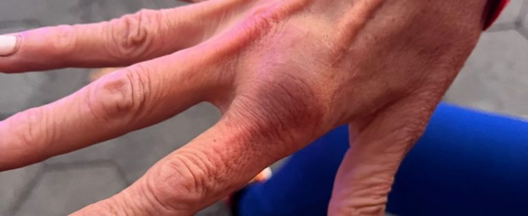 Un independentista agrede a dos aficionadas de la Selección y ataca con extrema violencia la bandera de España