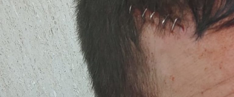 Dos policías heridos tras ataque con arma blanca en un domicilio del barrio Hortaleza (Madrid)