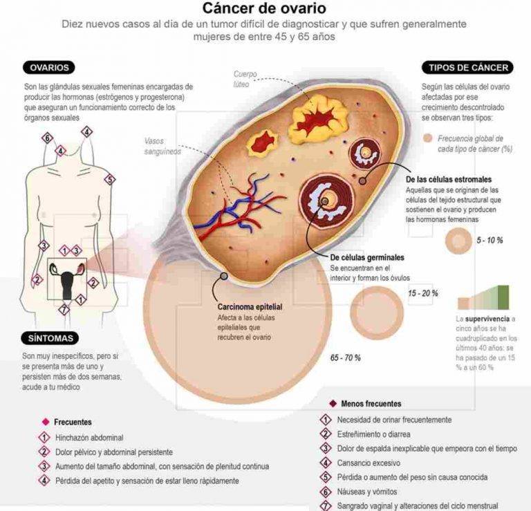 Síntomas de cáncer de ovario: dolores pélvicos y sangrado vaginal inapropiado