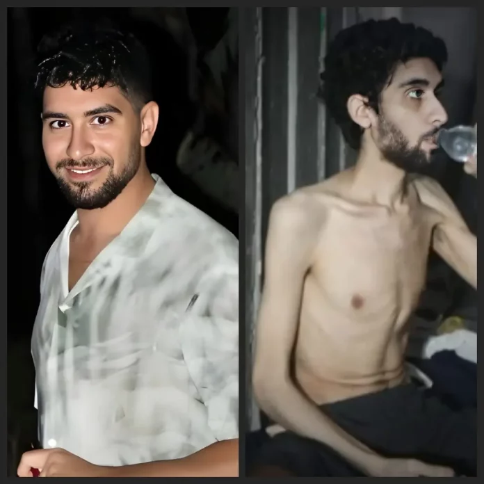Experimento de hambre de Hamás nazi con un judío, Evyatar David,, Israel, Gaza (1) FOTOGRAFÍA. GAZA (FRANJA DE GAZA), 02 DE JULIO DE 2025. La familia de Evyatar David (en la izquierda -antes del ataque terrorista del 7 de octubre de 2023 y su secuestro- y derecha de la imagen -en cautiverio-), uno de los rehenes israelíes en manos del grupo nazi-islamista Hamás ISIS, ha autorizado a la prensa este sábado la publicación editada de una parte del video que los islamofascistas difundieron la noche anterior. El grupo terrorista socio de los promotores de la campaña internacional antiIsrael y antisemita, usa a un judío como experimento de hambre bajo tierra en el califato islámico de Gaza. Lasvocesdelpueblo (Ñ Pueblo)