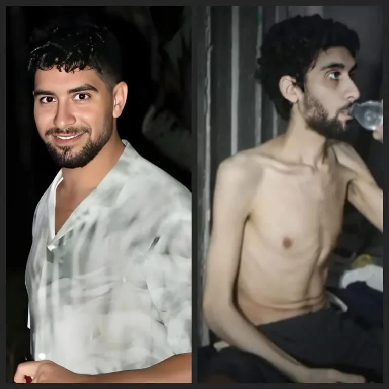 FOTOGRAFÍA. GAZA (FRANJA DE GAZA), 02 DE JULIO DE 2025. La familia de Evyatar David (en la izquierda -antes del ataque terrorista del 7 de octubre de 2023 y su secuestro- y derecha de la imagen -en cautiverio-), uno de los rehenes israelíes en manos del grupo nazi-islamista Hamás ISIS, ha autorizado a la prensa este sábado la publicación editada de una parte del video que los islamofascistas difundieron la noche anterior. El grupo terrorista socio de los promotores de la campaña internacional antiIsrael y antisemita, usa a un judío como experimento de hambre bajo tierra en el califato islámico de Gaza. Lasvocesdelpueblo (Ñ Pueblo)