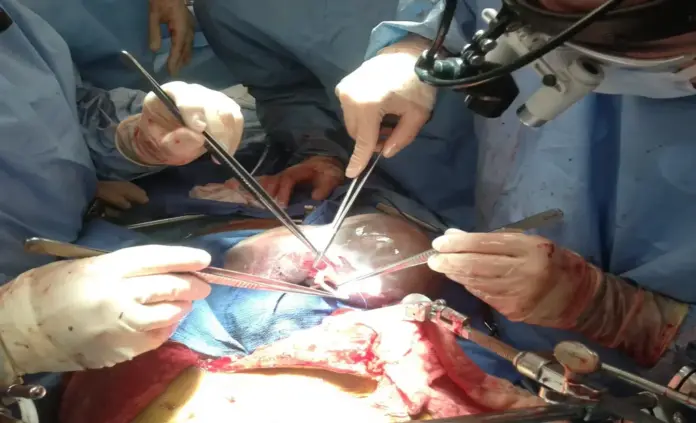 Un equipo multidisciplinar realiza dos trasplantes hepáticos en 9 horas en Granada, quirófano, cirujanos, anestesiólogos, enfermeros, médicos intensivistas y celadores FOTOGRAFÍA. ESPAÑA, 06 DE JUNIO DE 2026. Un equipo multidisciplinar realiza dos trasplantes hepáticos en 9 horas en Granada. Detalle de varios profesionales durante el trasplante de hígado en un quirófano. Efe